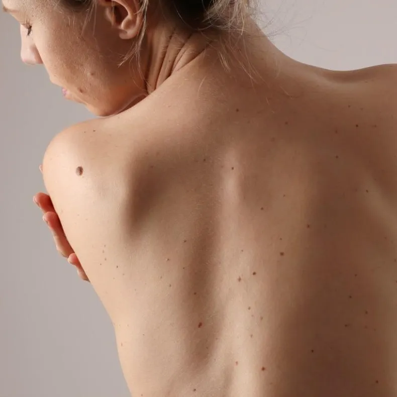 skin check north lakes skin check north lakes